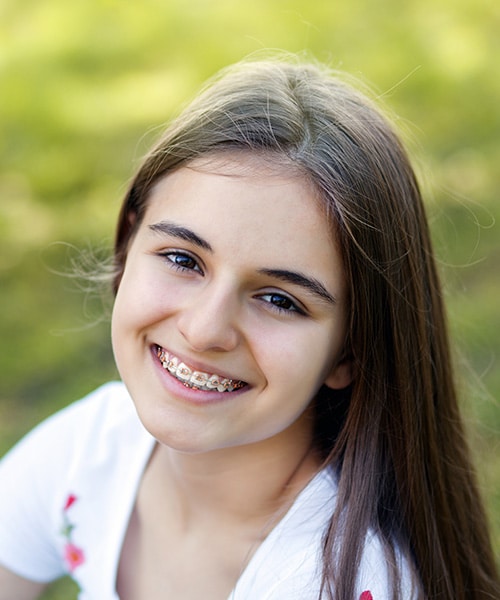 Types of braces at Up North Orthodontics in Traverse City and Beulah, MI